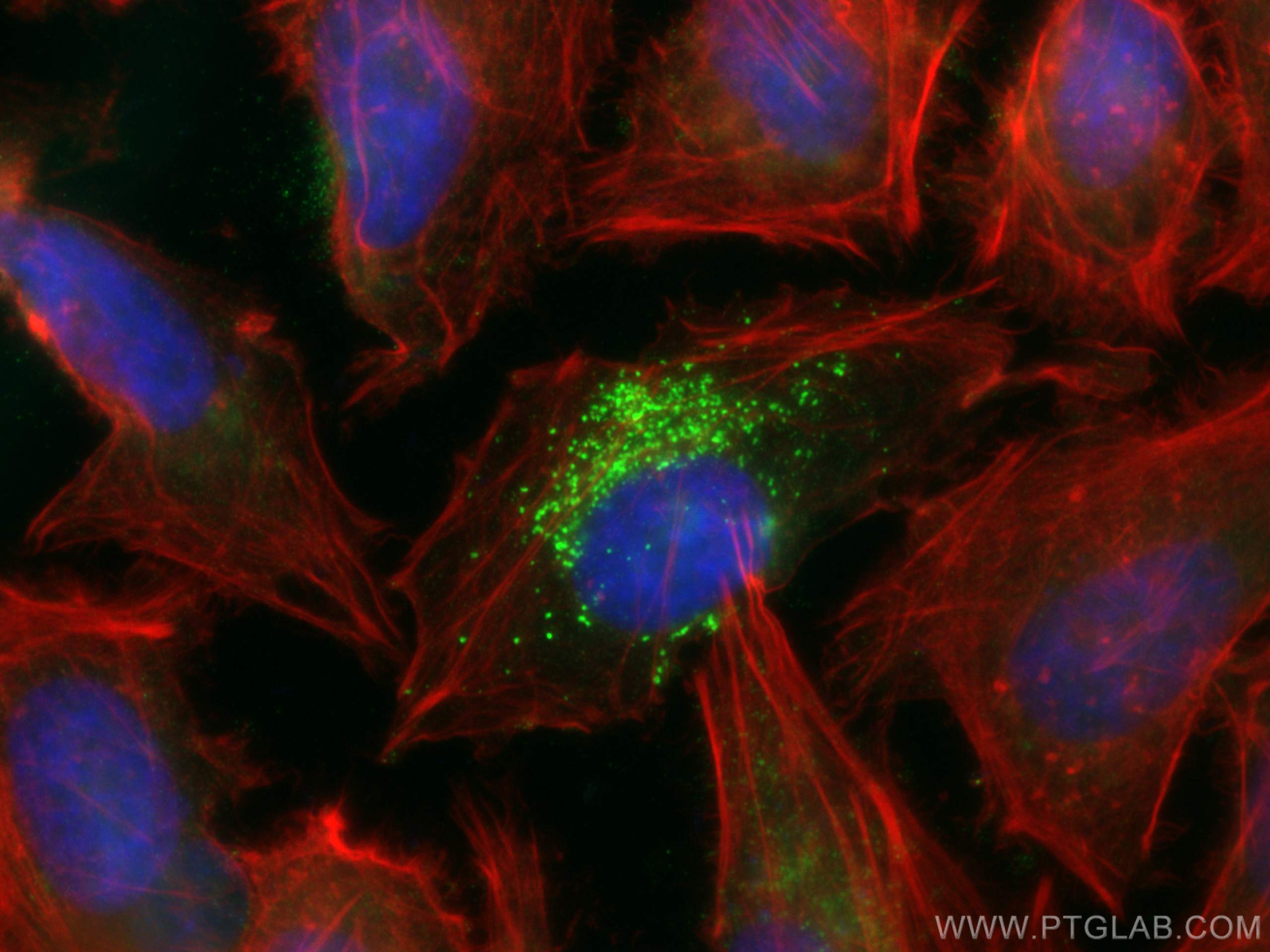 Immunofluorescence (IF) / fluorescent staining of HeLa cells using SNF8 Monoclonal antibody (67696-1-Ig)