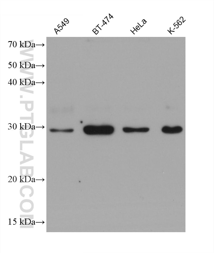 Western Blot (WB) analysis of various lysates using SNF8 Monoclonal antibody (67696-1-Ig)