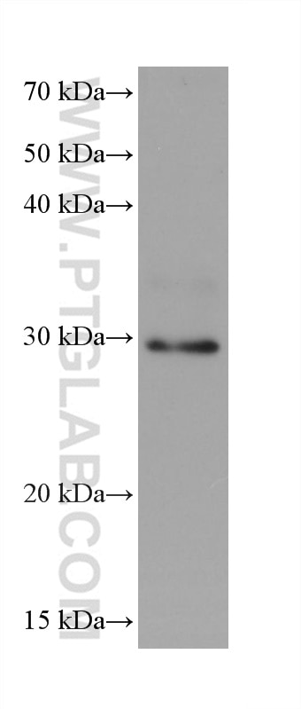 Western Blot (WB) analysis of U2OS cells using SNF8 Monoclonal antibody (67696-1-Ig)