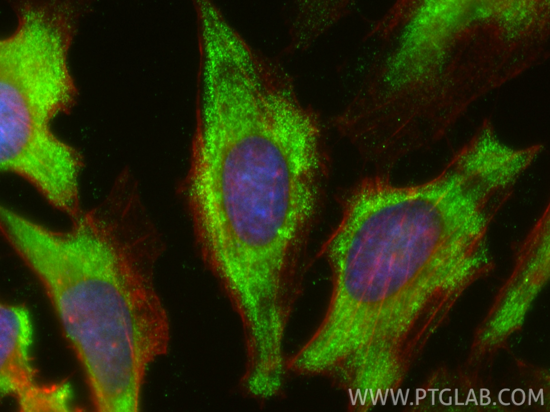 Immunofluorescent analysis of (-20°C Ethanol) fixed HeLa cells using CoraLite® Plus 488 SNF8 antibody (CL488-67696, Clone: 2C10F2 ) at dilution of 1:200, CL594-Phalloidin (red). Immunofluorescence (IF) / fluorescent staining of HeLa cells using CoraLite® Plus 488-conjugated SNF8 Monoclonal anti (CL488-67696)