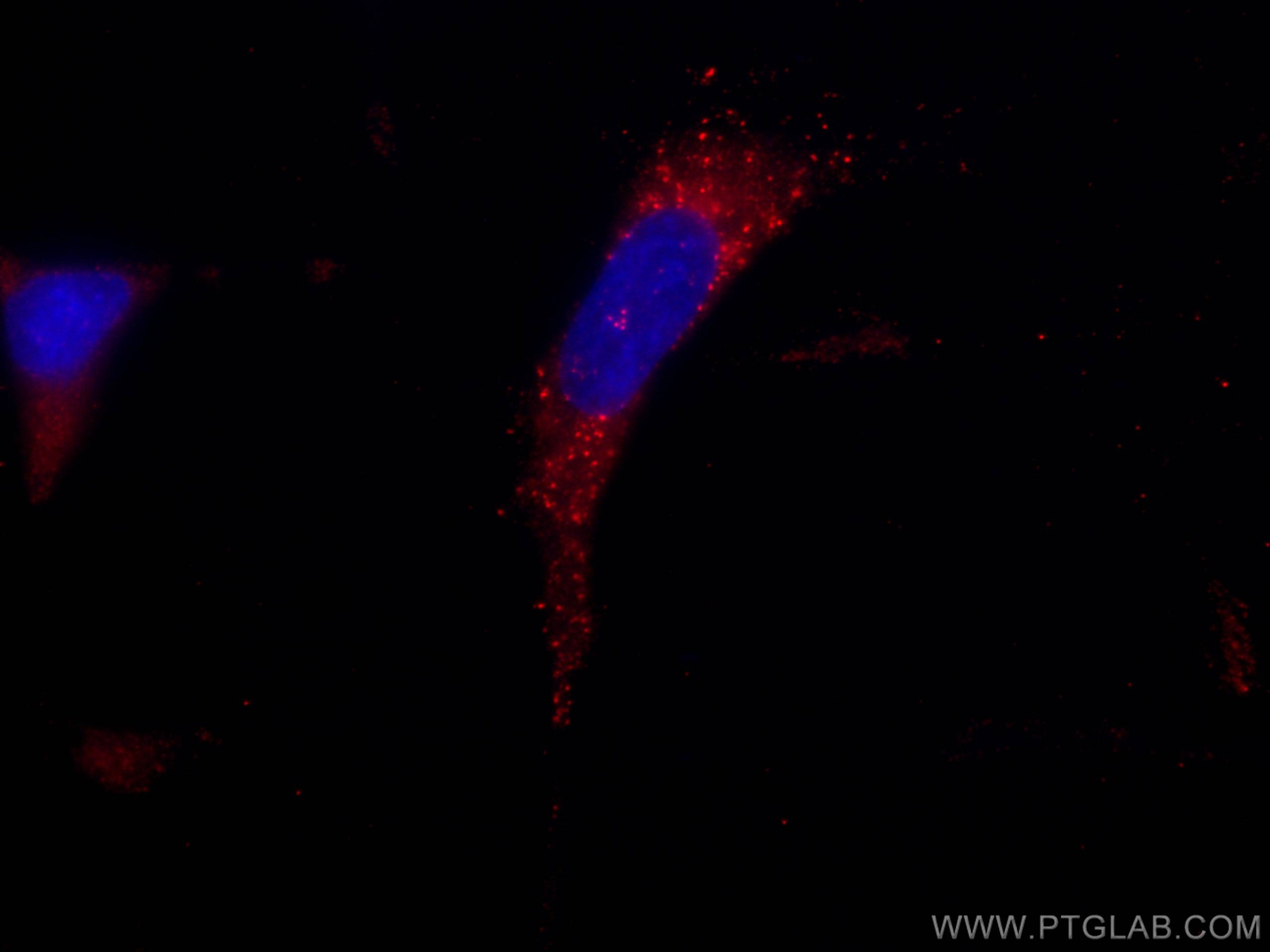 Immunofluorescence (IF) / fluorescent staining of HeLa cells using CoraLite®594-conjugated SNF8 Monoclonal antibody (CL594-67696)