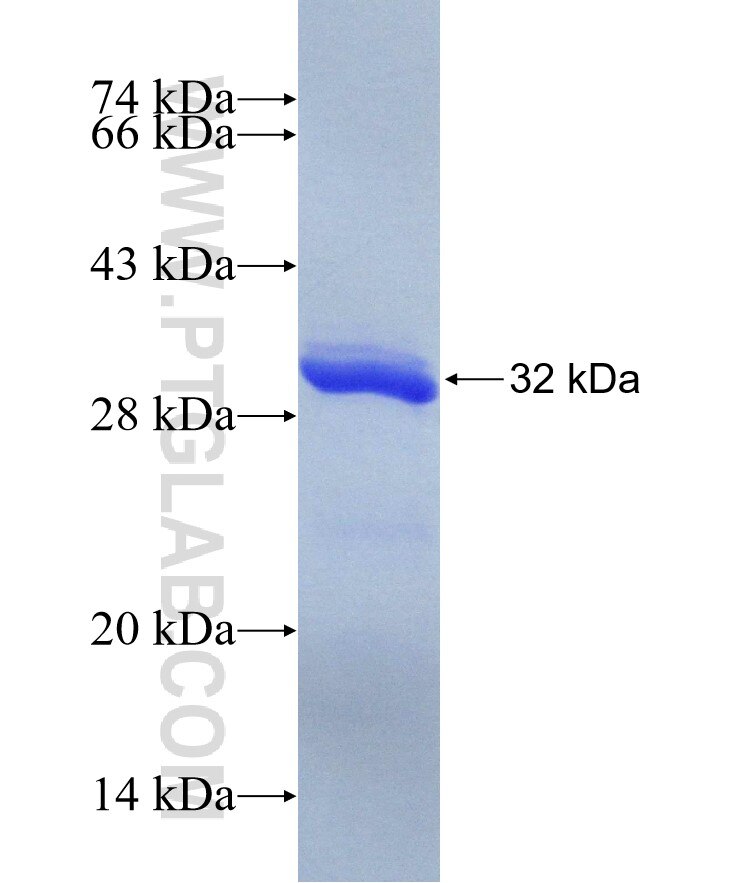 SNF8 fusion protein Ag30384 SDS-PAGE