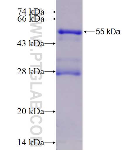 SNF8 fusion protein Ag2606 SDS-PAGE