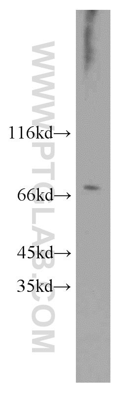 Western Blot (WB) analysis of Jurkat cells using RCC1 Polyclonal antibody (10697-1-AP)
