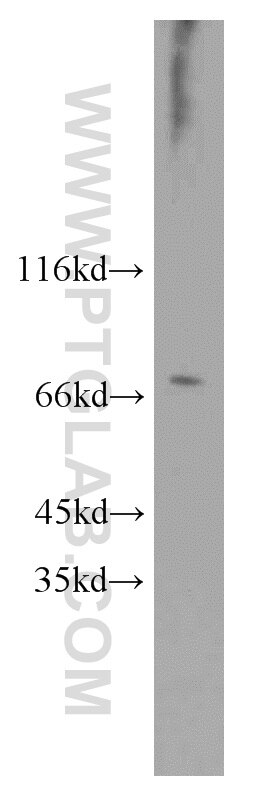 Western Blot (WB) analysis of Jurkat cells using RCC1 Polyclonal antibody (10697-1-AP)