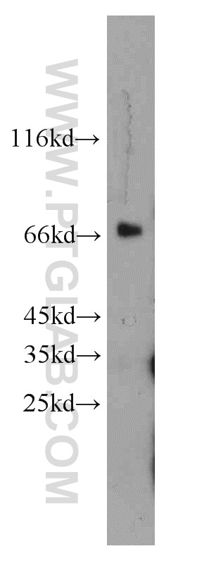 Western Blot (WB) analysis of mouse testis tissue using RCC1 Polyclonal antibody (10697-1-AP)