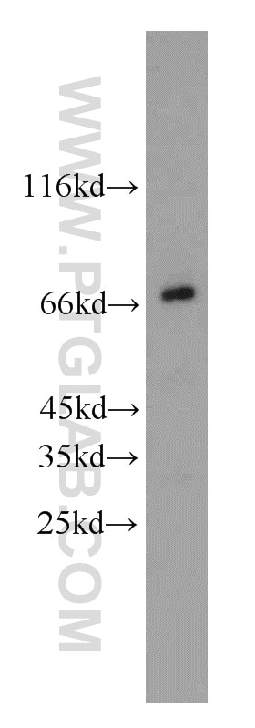 Western Blot (WB) analysis of Raji cells using RCC1 Polyclonal antibody (10697-1-AP)
