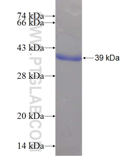 SNHG3-RCC1 fusion protein Ag24891 SDS-PAGE