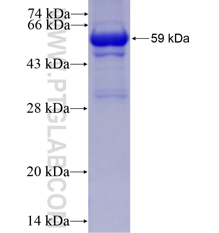 SNHG3-RCC1 fusion protein Ag1042 SDS-PAGE