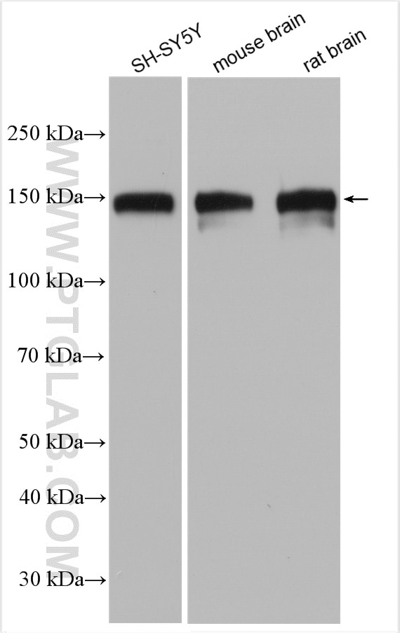 Western Blot (WB) analysis of various lysates using SNIP/p140Cap Polyclonal antibody (29890-1-AP)