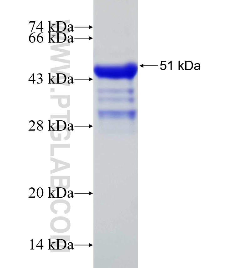 SNIP fusion protein Ag31857 SDS-PAGE