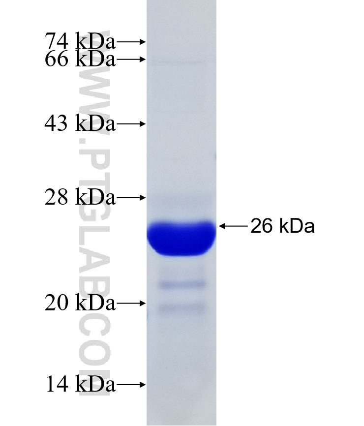 SNIP fusion protein Ag31869 SDS-PAGE