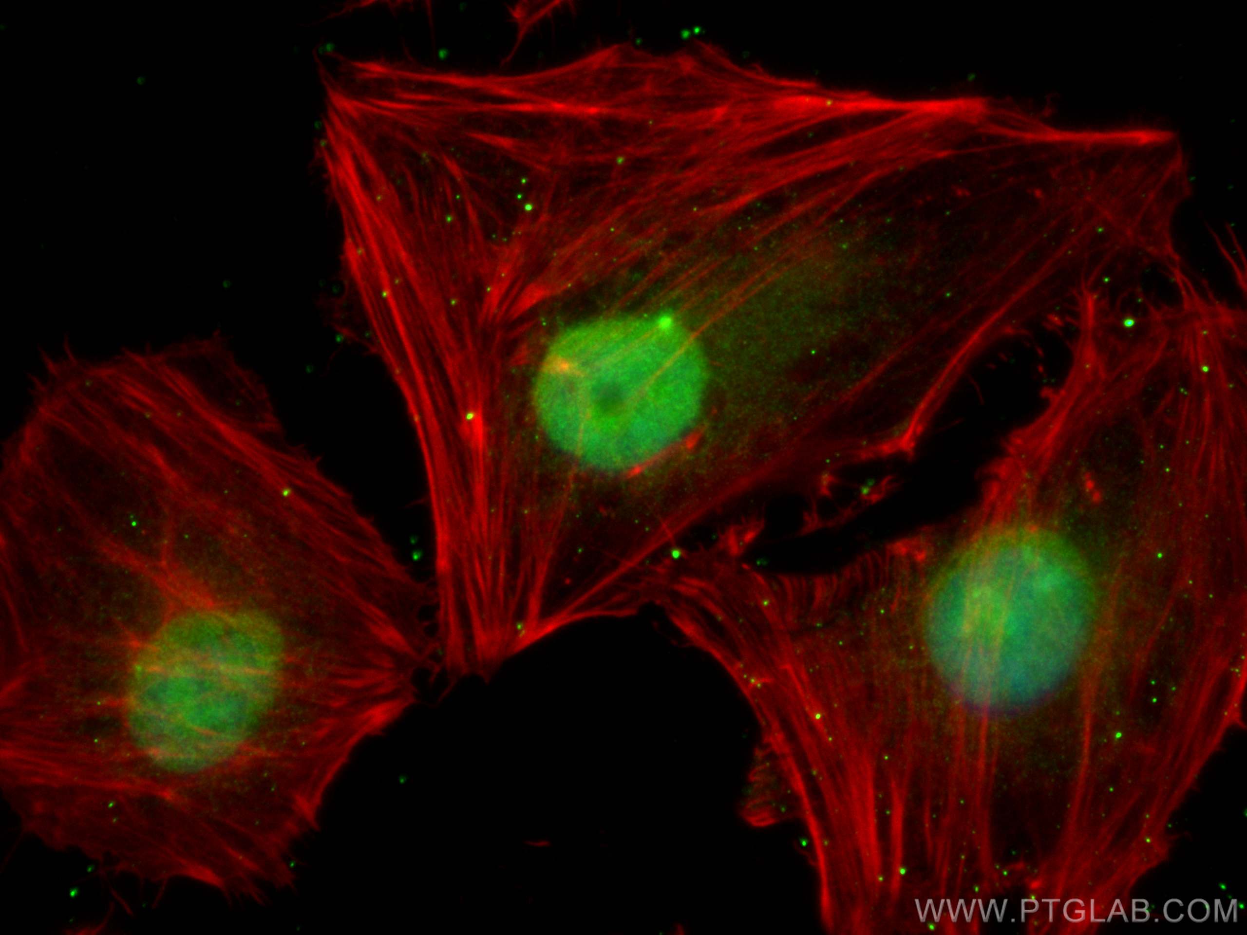 Immunofluorescence (IF) / fluorescent staining of HeLa cells using SNIP1 Polyclonal antibody (14950-1-AP)