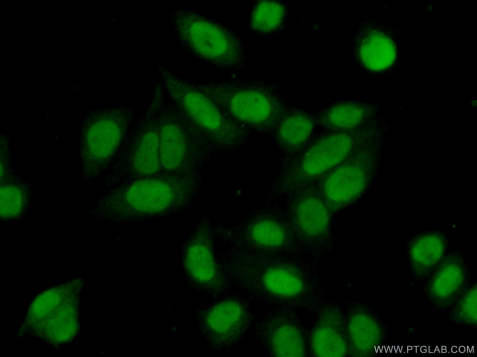 Immunofluorescence (IF) / fluorescent staining of HeLa cells using SNIP1 Polyclonal antibody (14950-1-AP)