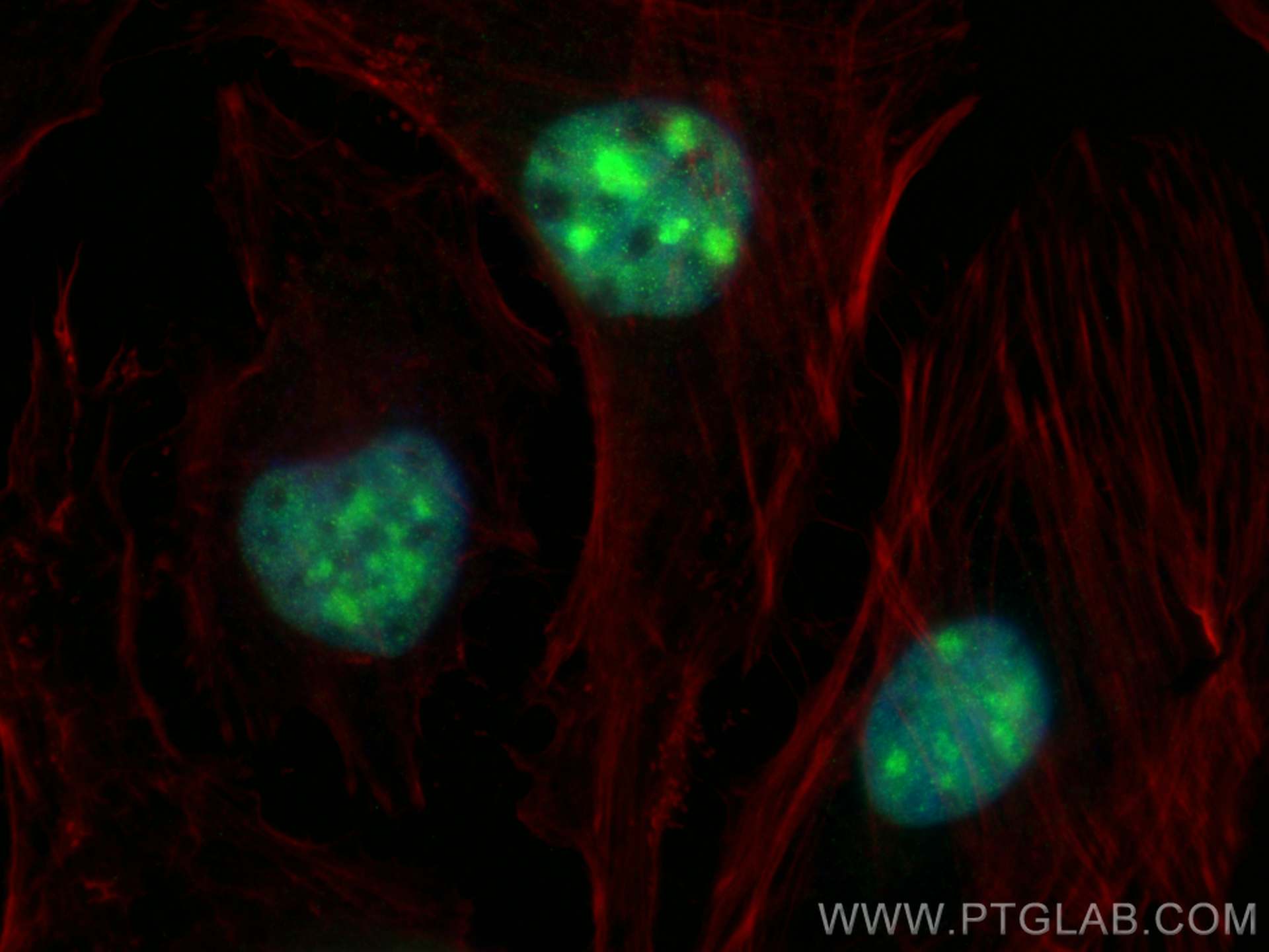 IF Staining of HeLa using 82962-1-RR