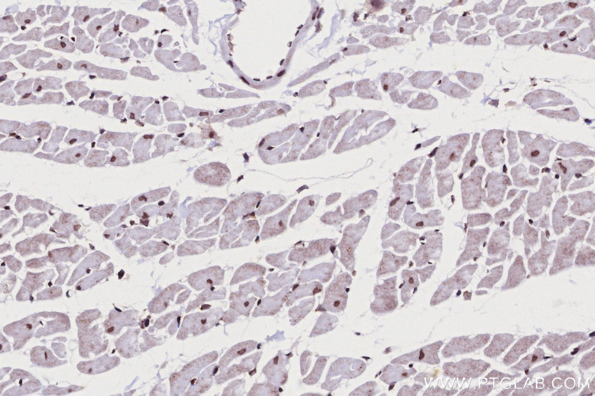 IHC staining of rat heart using 82962-1-RR Immunohistochemistry (IHC) staining of rat heart tissue using SNIP1 Recombinant monoclonal antibody (82962-1-RR)