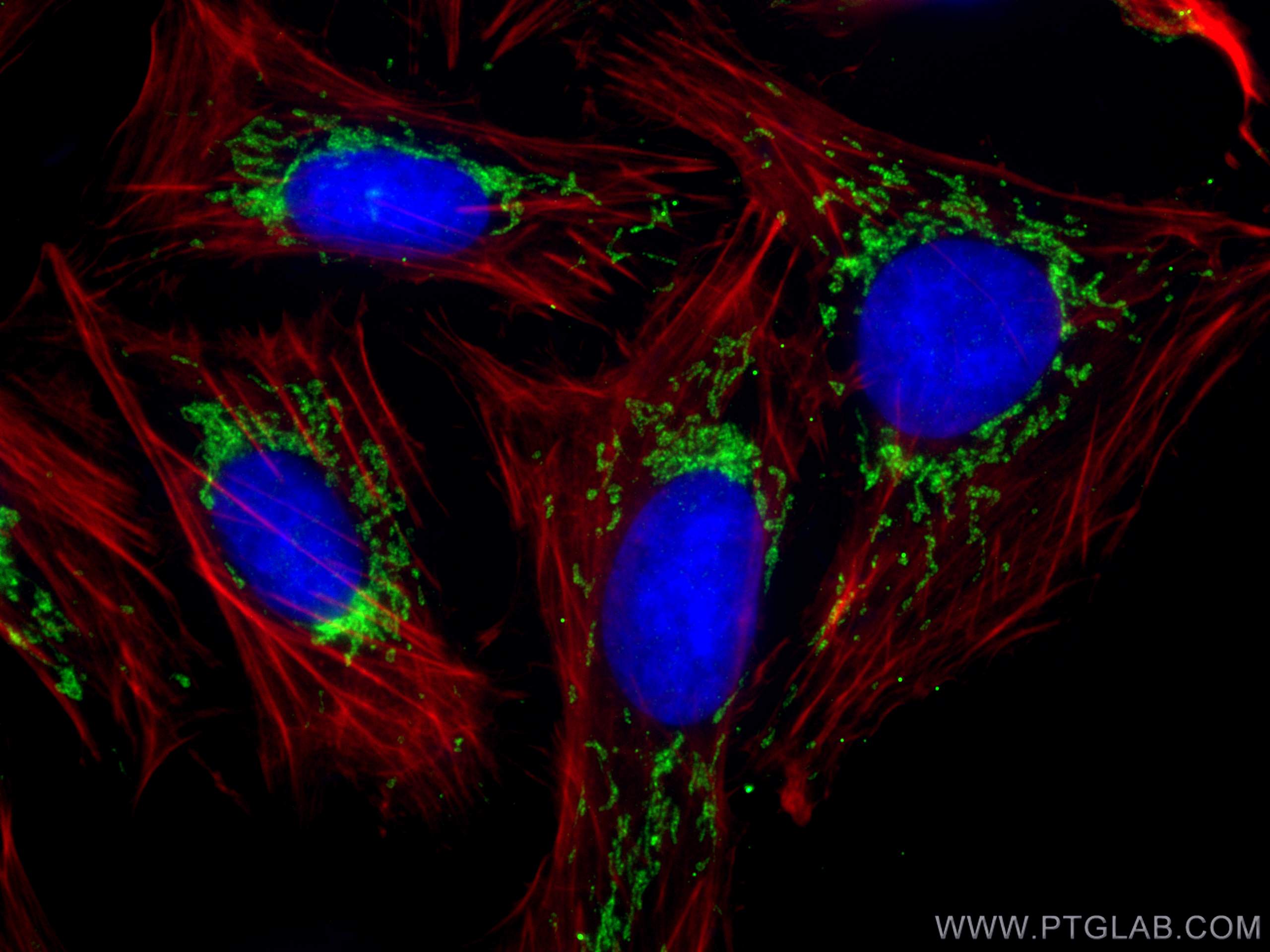 Immunofluorescence (IF) / fluorescent staining of U2OS cells using SNN Polyclonal antibody (13914-1-AP)