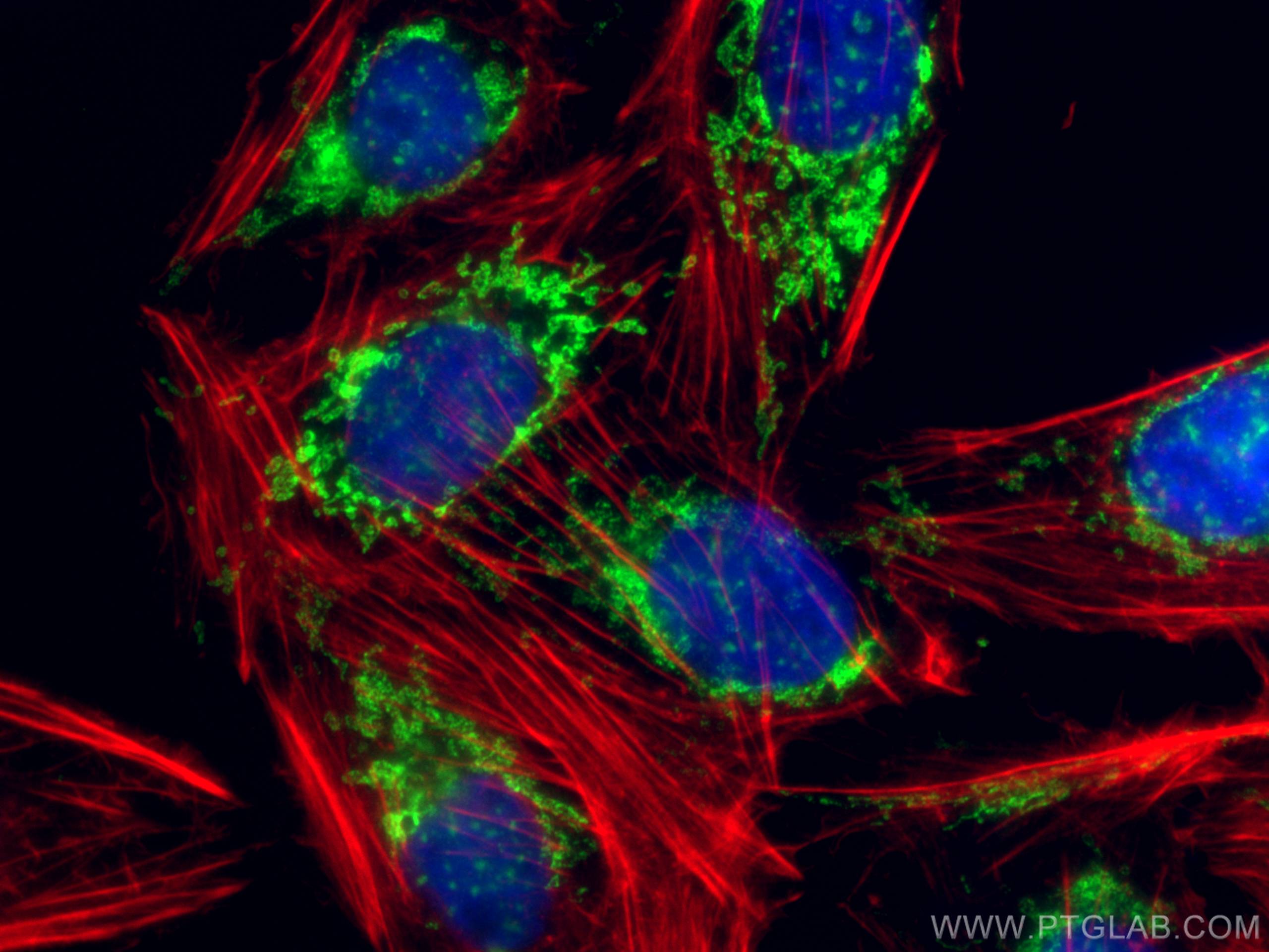 IF Staining of U2OS using 13914-1-AP