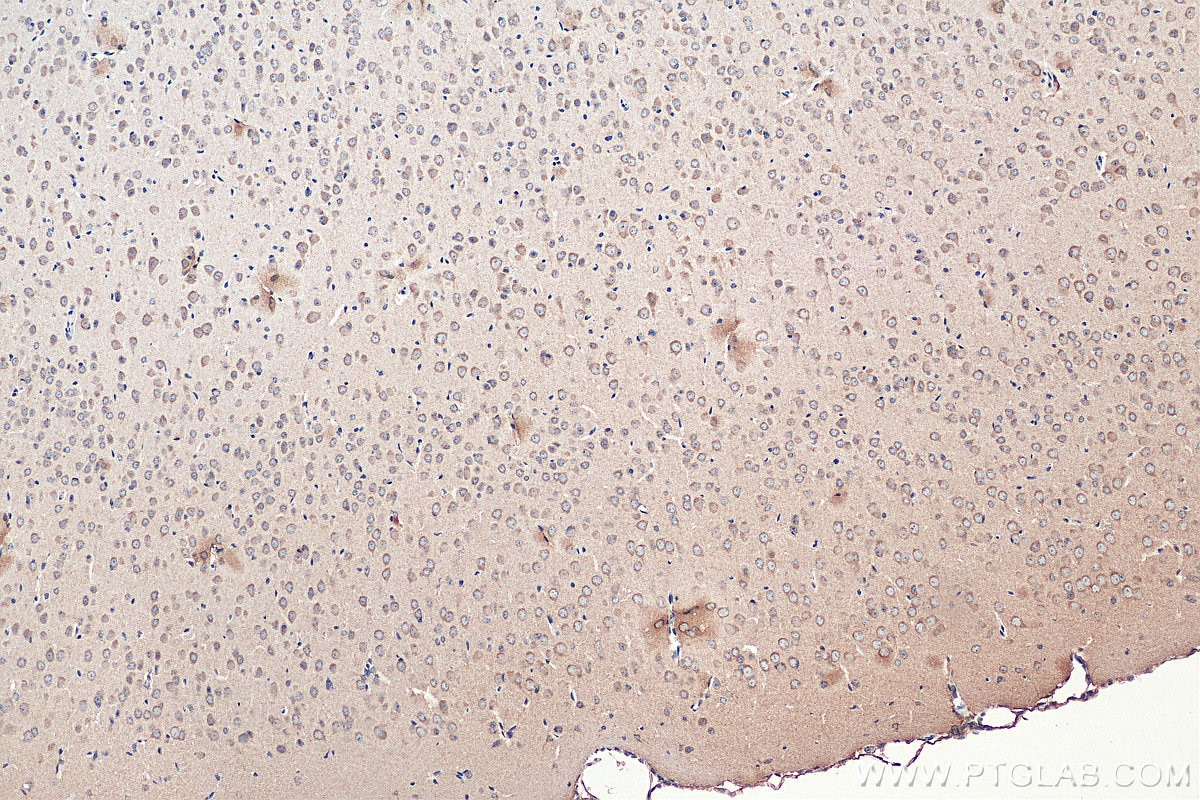 Immunohistochemistry (IHC) staining of mouse brain tissue using SNN Polyclonal antibody (13914-1-AP)