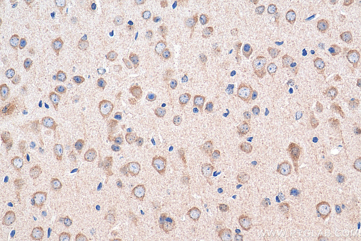 Immunohistochemistry (IHC) staining of mouse brain tissue using SNN Polyclonal antibody (13914-1-AP)