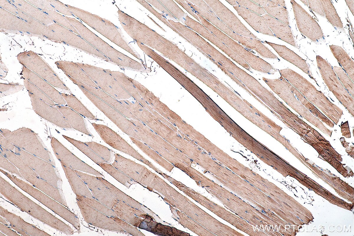 Immunohistochemistry (IHC) staining of mouse skeletal muscle tissue using SNN Polyclonal antibody (13914-1-AP)