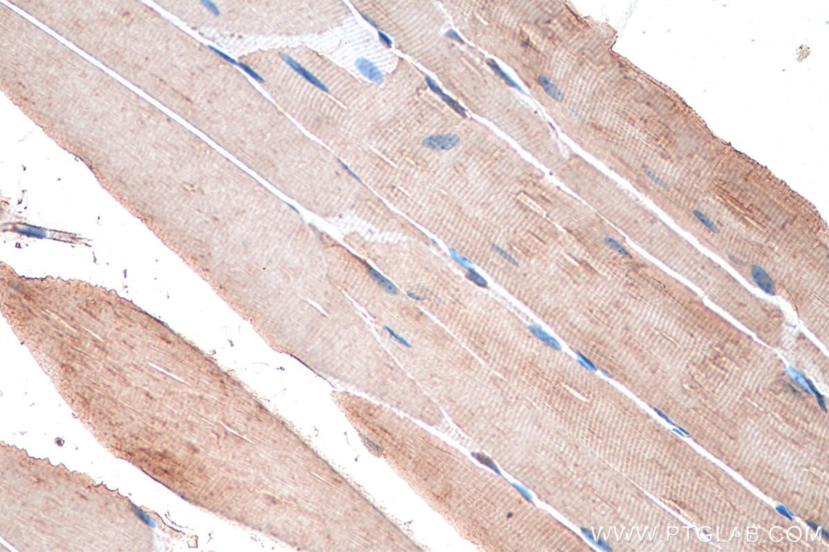 Immunohistochemistry (IHC) staining of mouse skeletal muscle tissue using SNN Polyclonal antibody (13914-1-AP)