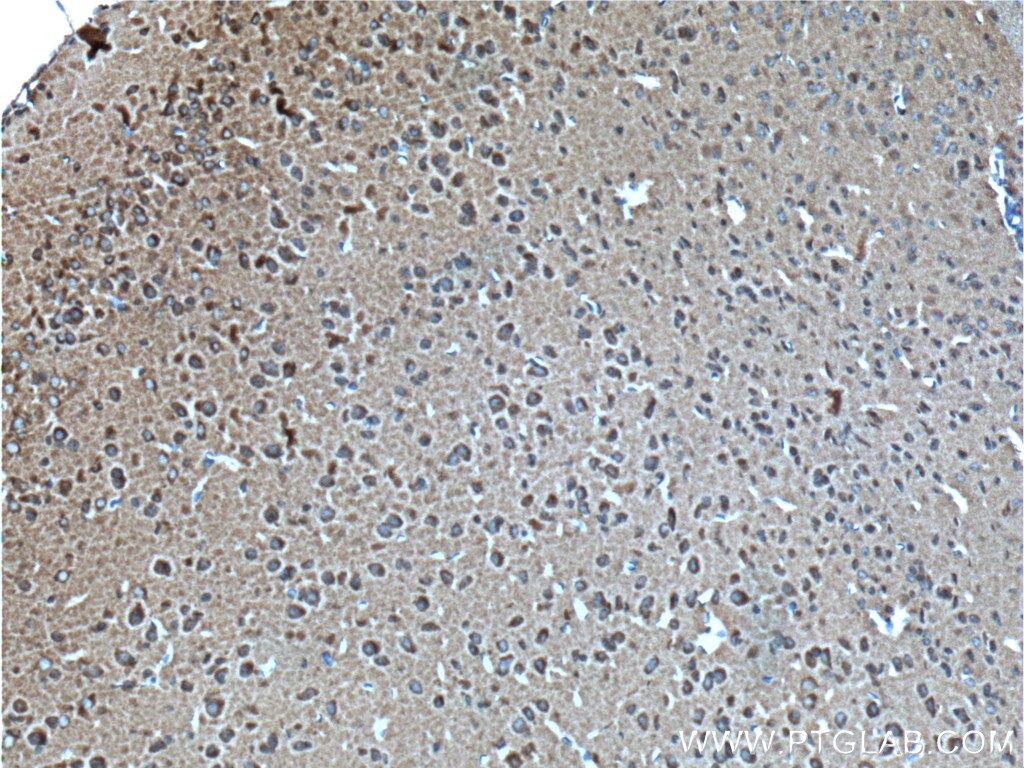 Immunohistochemistry (IHC) staining of mouse brain tissue using Syntaphilin Polyclonal antibody (13646-1-AP)