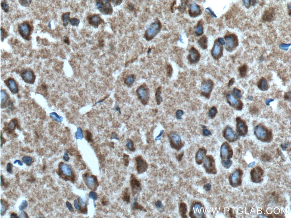 Immunohistochemistry (IHC) staining of mouse brain tissue using Syntaphilin Polyclonal antibody (13646-1-AP)