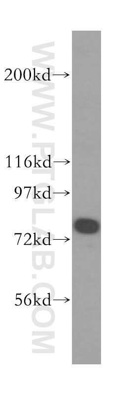 Western Blot (WB) analysis of mouse trachea tissue using Syntaphilin Polyclonal antibody (13646-1-AP)