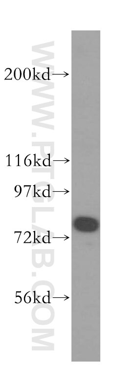 WB analysis of mouse trachea using 13646-1-AP