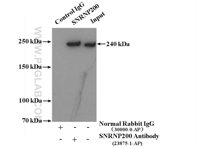 Immunoprecipitation (IP) experiment of HeLa cells using SNRNP200 Polyclonal antibody (23875-1-AP)