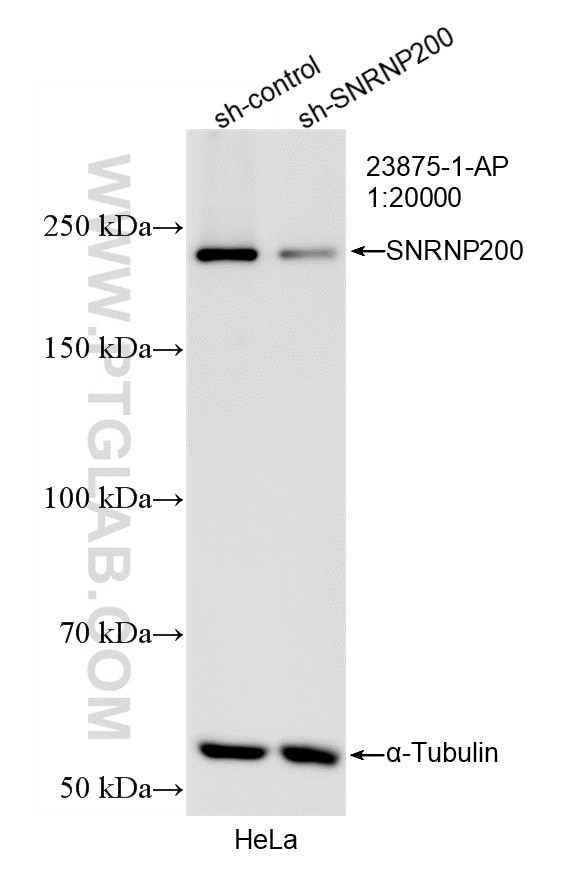 WB result of SNRNP200 antibody (23875-1-AP; 1:20000; incubated at room temperature for 1.5 hours) with sh-Control and sh-SNRNP200 transfected HeLa cells. Western Blot (WB) analysis of HeLa cells using SNRNP200 Polyclonal antibody (23875-1-AP)