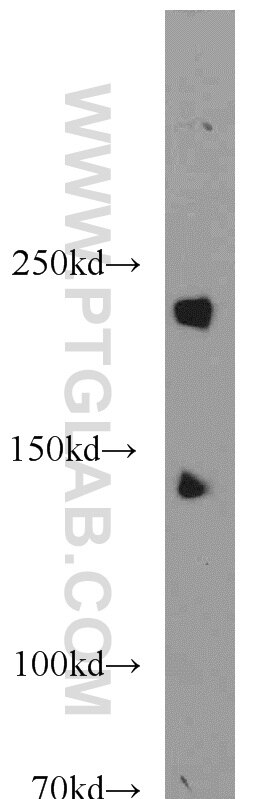 Western Blot (WB) analysis of NIH/3T3 cells using SNRNP200 Polyclonal antibody (23875-1-AP)