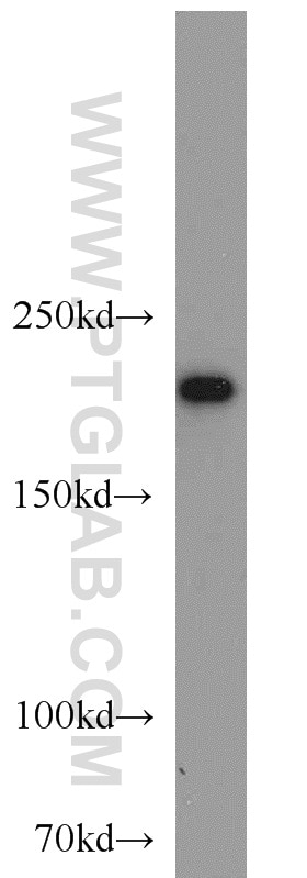 Western Blot (WB) analysis of HeLa cells using SNRNP200 Polyclonal antibody (23875-1-AP)
