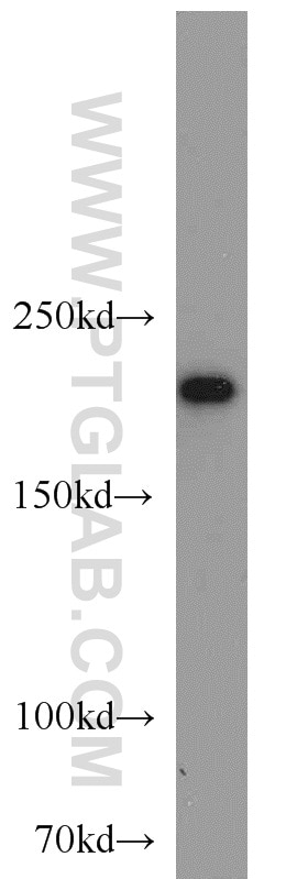 WB analysis of HeLa using 23875-1-AP