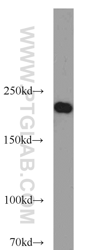 Western Blot (WB) analysis of HEK-293 cells using SNRNP200 Polyclonal antibody (23875-1-AP)