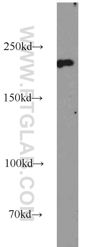 Western Blot (WB) analysis of Jurkat cells using SNRNP200 Polyclonal antibody (23875-1-AP)