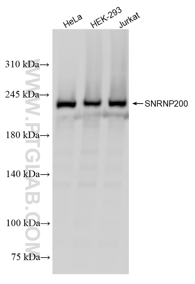 SNRNP200