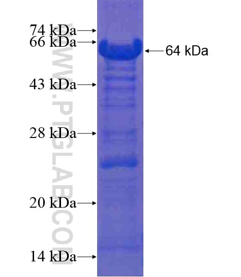 SNRNP200 fusion protein Ag20748 SDS-PAGE