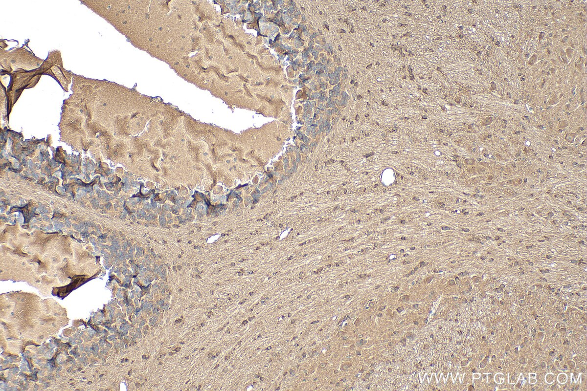 Immunohistochemistry (IHC) staining of mouse cerebellum tissue using SNRNP25 Polyclonal antibody (19890-1-AP)