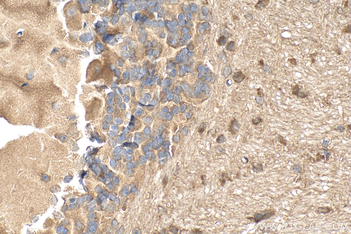 Immunohistochemistry (IHC) staining of mouse cerebellum tissue using SNRNP25 Polyclonal antibody (19890-1-AP)