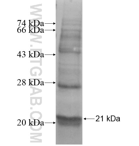 SNRNP25 fusion protein Ag13781 SDS-PAGE
