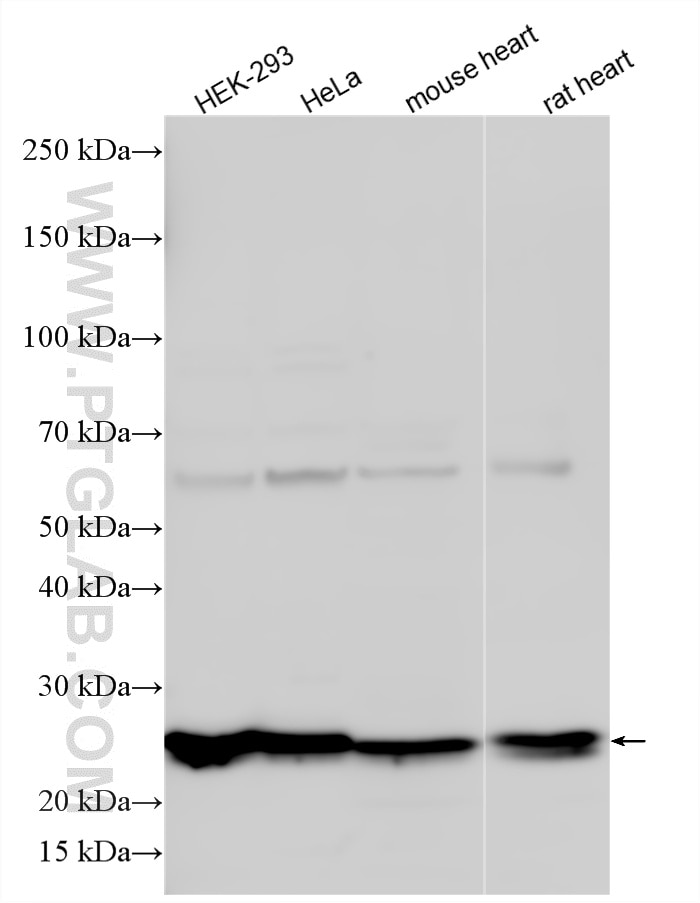 WB analysis using 20505-1-AP Western Blot (WB) analysis of various lysates using SNRNP27 Polyclonal antibody (20505-1-AP)
