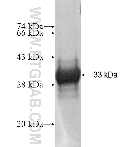 SNRNP27 fusion protein Ag14308 SDS-PAGE