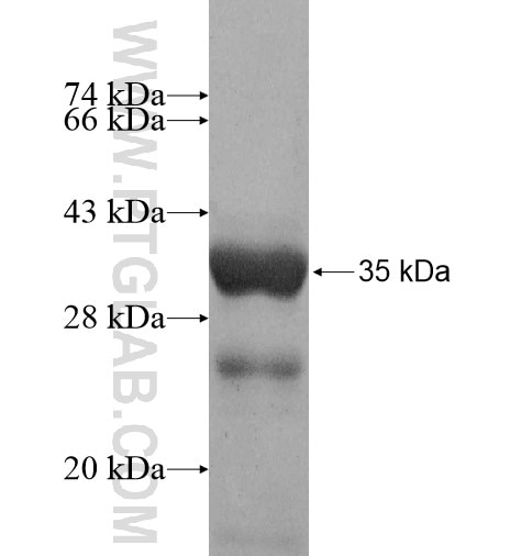 SNRNP35 fusion protein Ag11954 SDS-PAGE