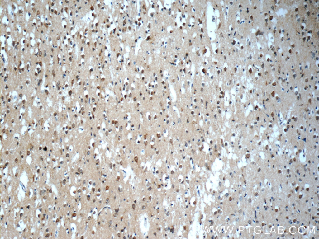 Immunohistochemistry (IHC) staining of human brain tissue using SNRNP48 Polyclonal antibody (24297-1-AP)