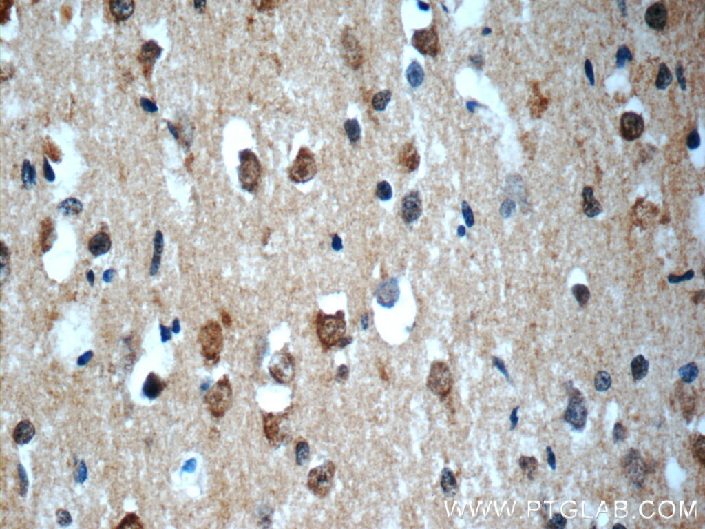 Immunohistochemistry (IHC) staining of human brain tissue using SNRNP48 Polyclonal antibody (24297-1-AP)