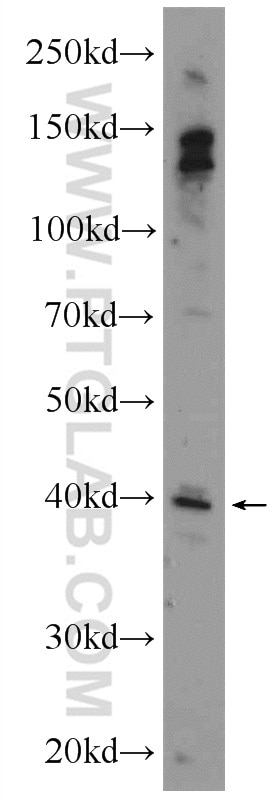 Western Blot (WB) analysis of mouse kidney tissue using SNRNP48 Polyclonal antibody (24297-1-AP)