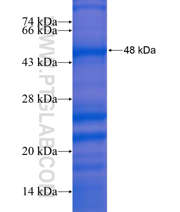 SNRNP48 fusion protein Ag18157 SDS-PAGE