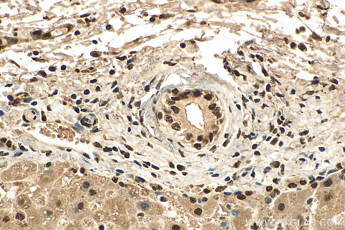 Immunohistochemistry (IHC) staining of human liver tissue using SNRPA Polyclonal antibody (10212-1-AP)
